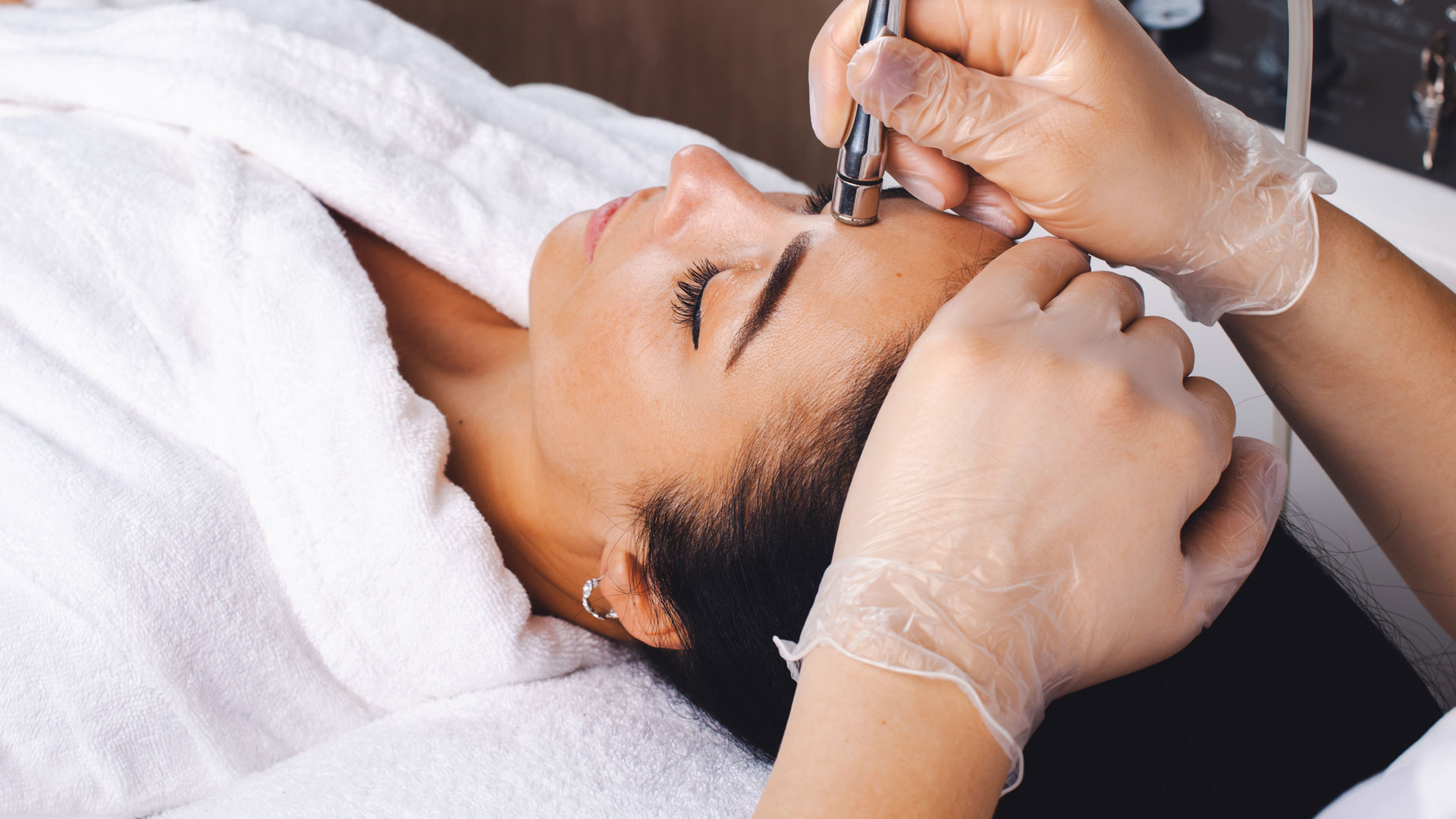 banner-microdermabrasion