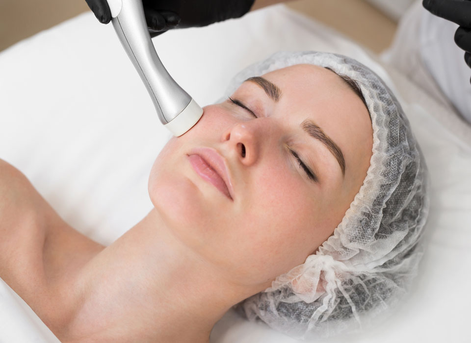 dermabrasion-benefits