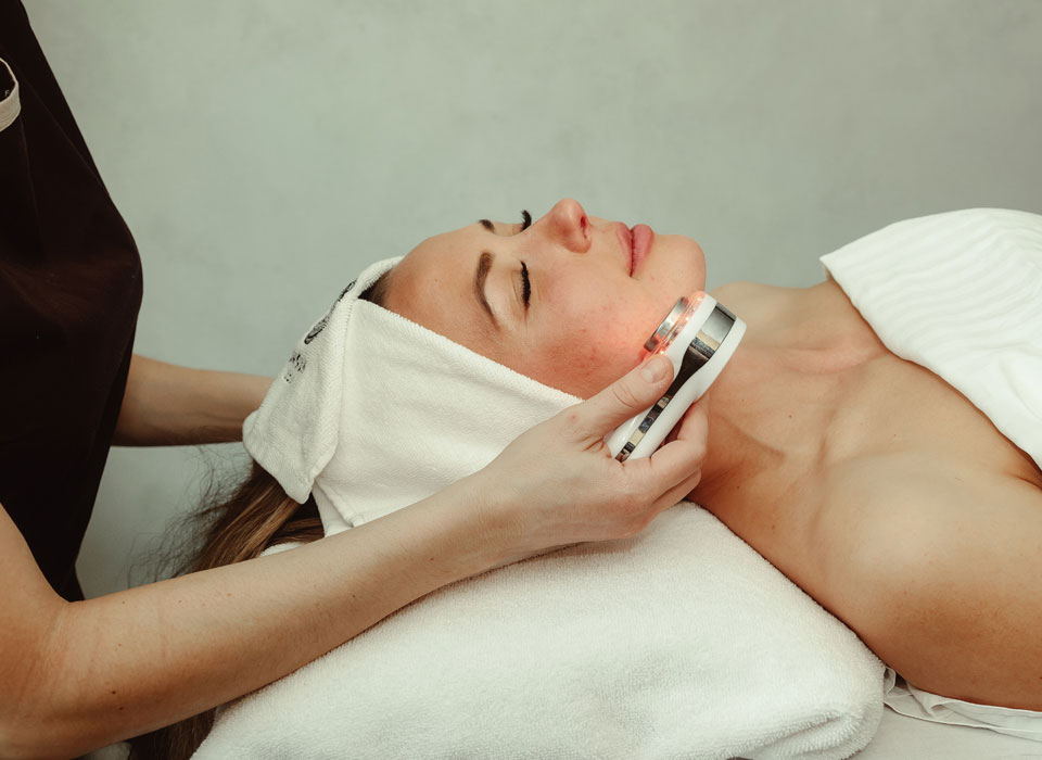 ipl-photofacial-benefits