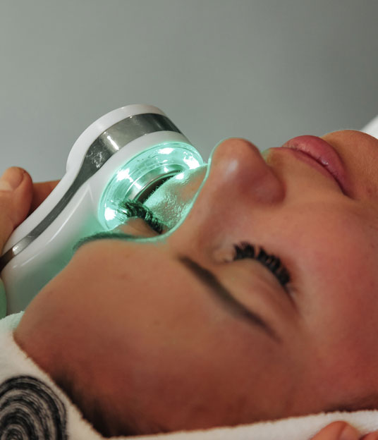 ipl-photofacial-first-steps